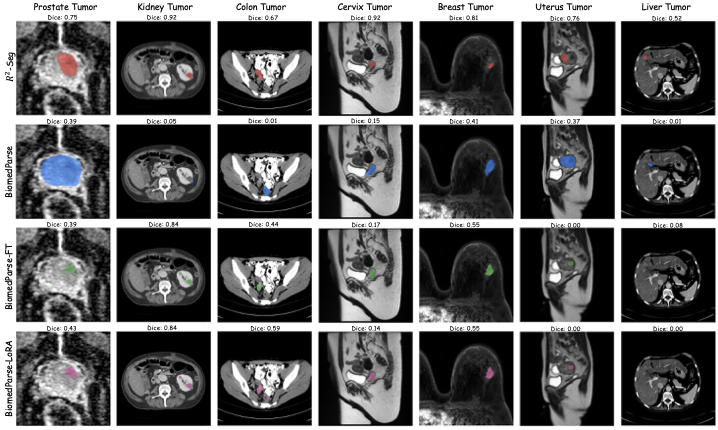 Segmentation results for ID and OOD tumors